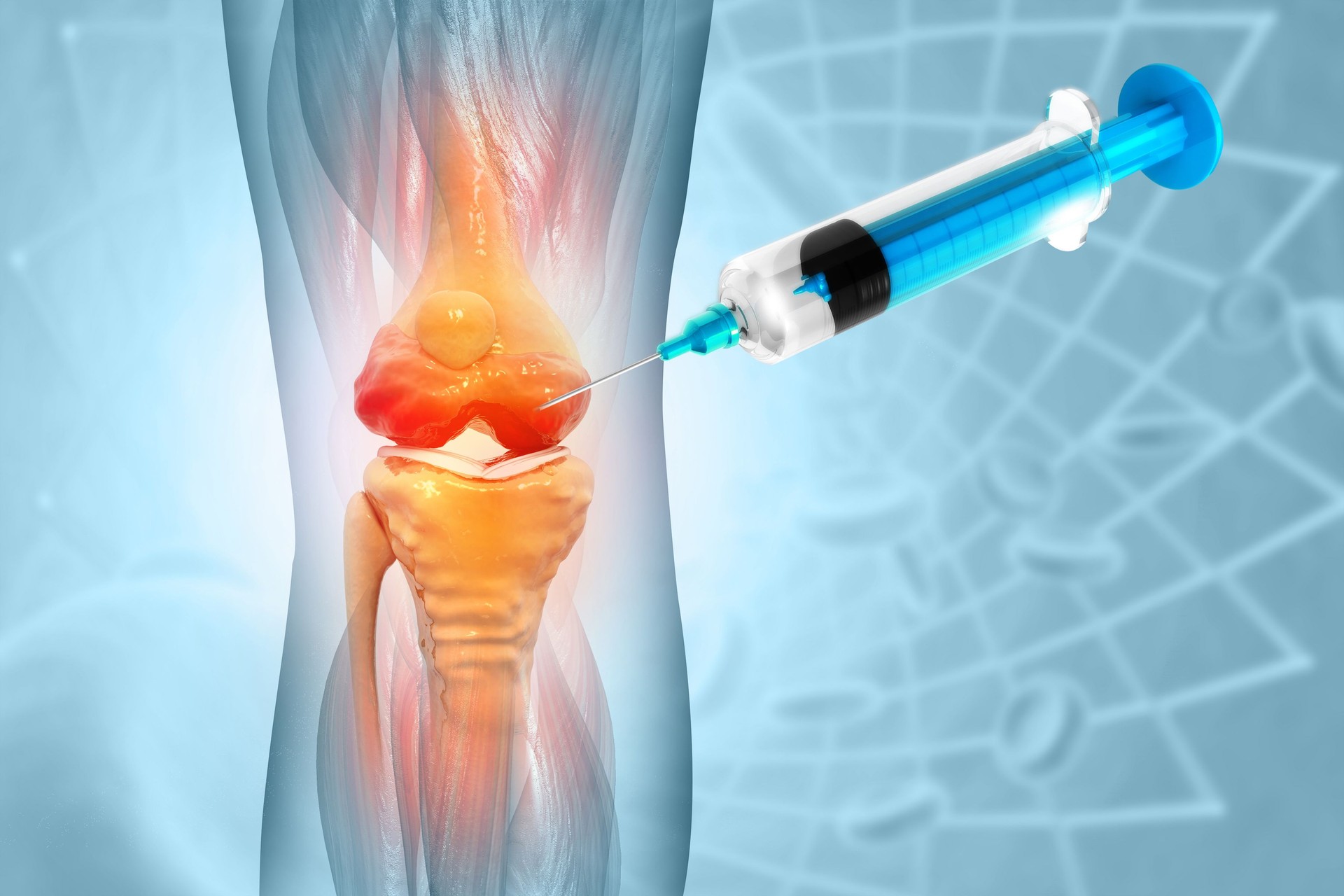 Anatomy Human Knee Joint Treatment, Osteoarthritis Injection, Drug Method Injection, knee injury, 3d illustration